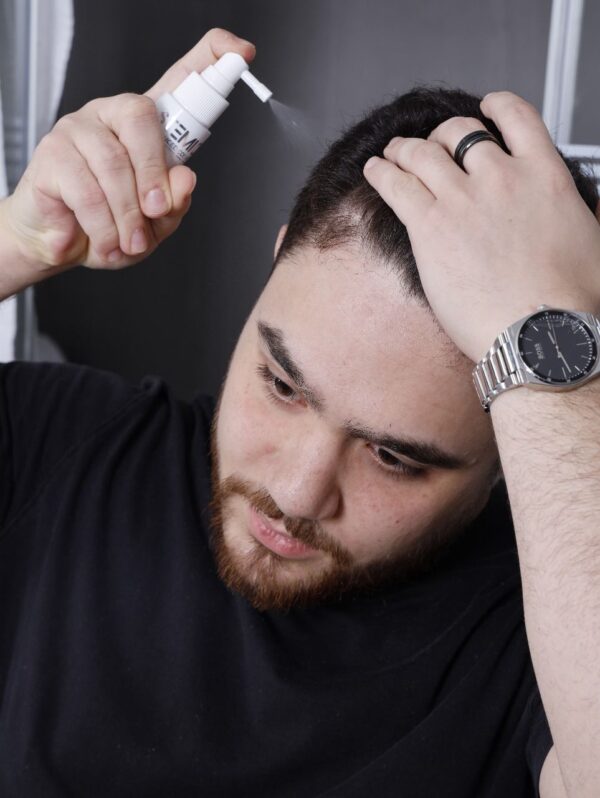 hair regrowth spray - Image 7